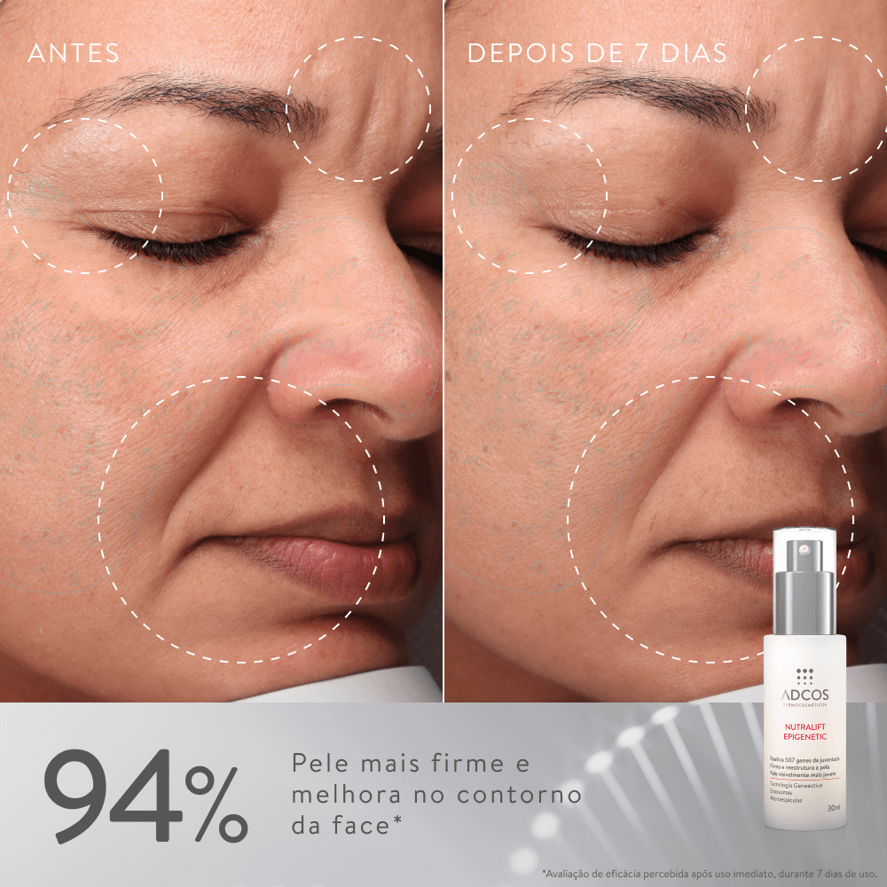 nutralift-epigenetic-30ml